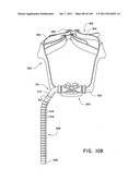 Nasal Assembly diagram and image