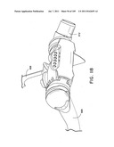 Nasal Assembly diagram and image