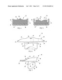 ORAL ORTHOSIS diagram and image