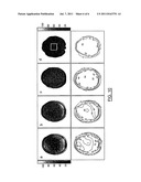 TRANSCEIVE SURFACE COIL ARRAY FOR MAGNETIC RESONANCE IMAGING AND     SPECTROSCOPY diagram and image