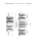 COMPUTER AIDED DIAGNOSIS USING DERIVED IMAGES diagram and image