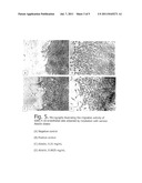 ANTITUMORAL TERPENOID PHARMACEUTICAL COMPOSITION  ABISILIN  EXHIBITING     ANGIOGENESIS-INHIBITING ACTION diagram and image