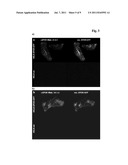 ANTIBODIES AGAINST HUMAN EPO RECEPTOR diagram and image