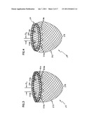 SELF-ADJUSTING ATTACHMENT STRUCTURE FOR A CARDIAC SUPPORT DEVICE diagram and image