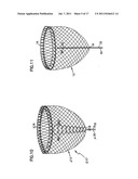 SELF-ADJUSTING ATTACHMENT STRUCTURE FOR A CARDIAC SUPPORT DEVICE diagram and image