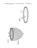 SELF-ADJUSTING ATTACHMENT STRUCTURE FOR A CARDIAC SUPPORT DEVICE diagram and image