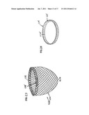 SELF-ADJUSTING ATTACHMENT STRUCTURE FOR A CARDIAC SUPPORT DEVICE diagram and image