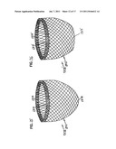 SELF-ADJUSTING ATTACHMENT STRUCTURE FOR A CARDIAC SUPPORT DEVICE diagram and image