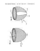 SELF-ADJUSTING ATTACHMENT STRUCTURE FOR A CARDIAC SUPPORT DEVICE diagram and image