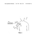 Patient Event Marking in Combination with Physiological Signals diagram and image