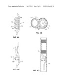 SYSTEM AND METHOD FOR TRANSVASCULARLY STIMULATING CONTENTS OF THE CAROTID     SHEATH diagram and image