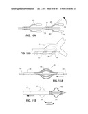 SYSTEM AND METHOD FOR TRANSVASCULARLY STIMULATING CONTENTS OF THE CAROTID     SHEATH diagram and image