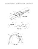 SYSTEM AND METHOD FOR TRANSVASCULARLY STIMULATING CONTENTS OF THE CAROTID     SHEATH diagram and image