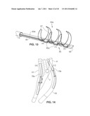 SYSTEM AND METHOD FOR TRANSVASCULARLY STIMULATING CONTENTS OF THE CAROTID     SHEATH diagram and image