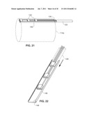 SYSTEM AND METHOD FOR TRANSVASCULARLY STIMULATING CONTENTS OF THE CAROTID     SHEATH diagram and image