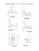 SYSTEM AND METHOD FOR TRANSVASCULARLY STIMULATING CONTENTS OF THE CAROTID     SHEATH diagram and image