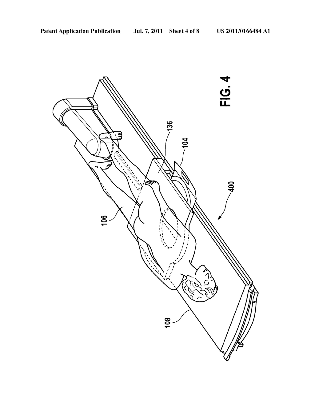 ULTRASONIC TREATMENT APPARATUS WITH A PROTECTIVE COVER - diagram, schematic, and image 05