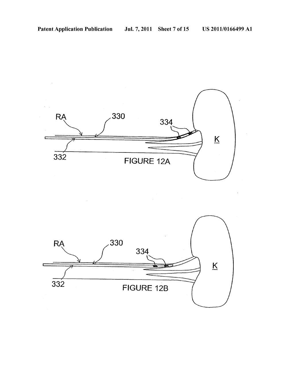 METHODS AND APPARATUS FOR INDUCING CONTROLLED RENAL NEUROMODULATION - diagram, schematic, and image 08