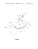  SURGICAL DRILL AIMER diagram and image