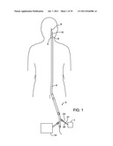 SYSTEMS, METHODS AND DEVICES FOR REMOVING OBSTRUCTIONS FROM A BLOOD VESSEL diagram and image