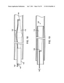 SYSTEMS, METHODS AND DEVICES FOR REMOVING OBSTRUCTIONS FROM A BLOOD VESSEL diagram and image