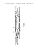 SYSTEMS, METHODS AND DEVICES FOR REMOVING OBSTRUCTIONS FROM A BLOOD VESSEL diagram and image