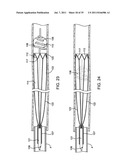 SYSTEMS, METHODS AND DEVICES FOR REMOVING OBSTRUCTIONS FROM A BLOOD VESSEL diagram and image