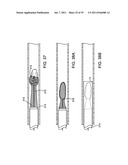 SYSTEMS, METHODS AND DEVICES FOR REMOVING OBSTRUCTIONS FROM A BLOOD VESSEL diagram and image