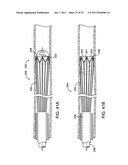 SYSTEMS, METHODS AND DEVICES FOR REMOVING OBSTRUCTIONS FROM A BLOOD VESSEL diagram and image