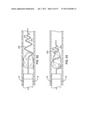 SYSTEMS, METHODS AND DEVICES FOR REMOVING OBSTRUCTIONS FROM A BLOOD VESSEL diagram and image