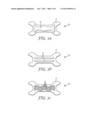 THIN FILM NASAL DILATOR WITH DELIVERY SYSTEM diagram and image