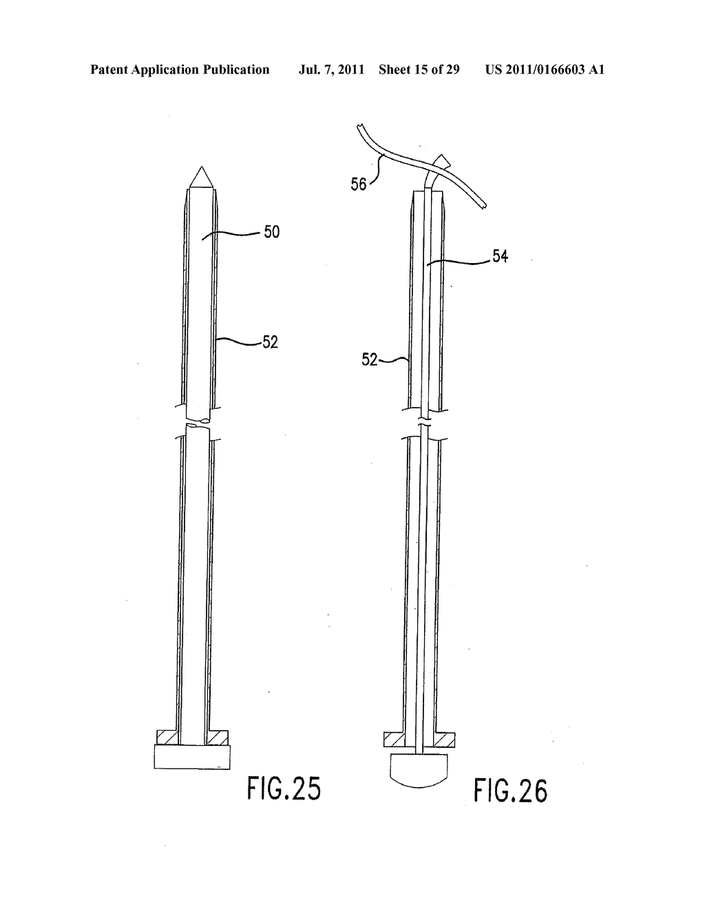METHOD AND DEVICE FOR PLACING MATERIALS IN THE SPINE - diagram, schematic, and image 16