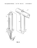 METHOD AND ASSOCIATED INSTRUMENTATION FOR INSTALLATION OF SPINAL DYNAMIC     STABILIZATION SYSTEM diagram and image