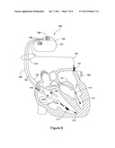 Automatic Multi-Level Therapy Based on Morphologic Organization of an     Arrhythmia diagram and image