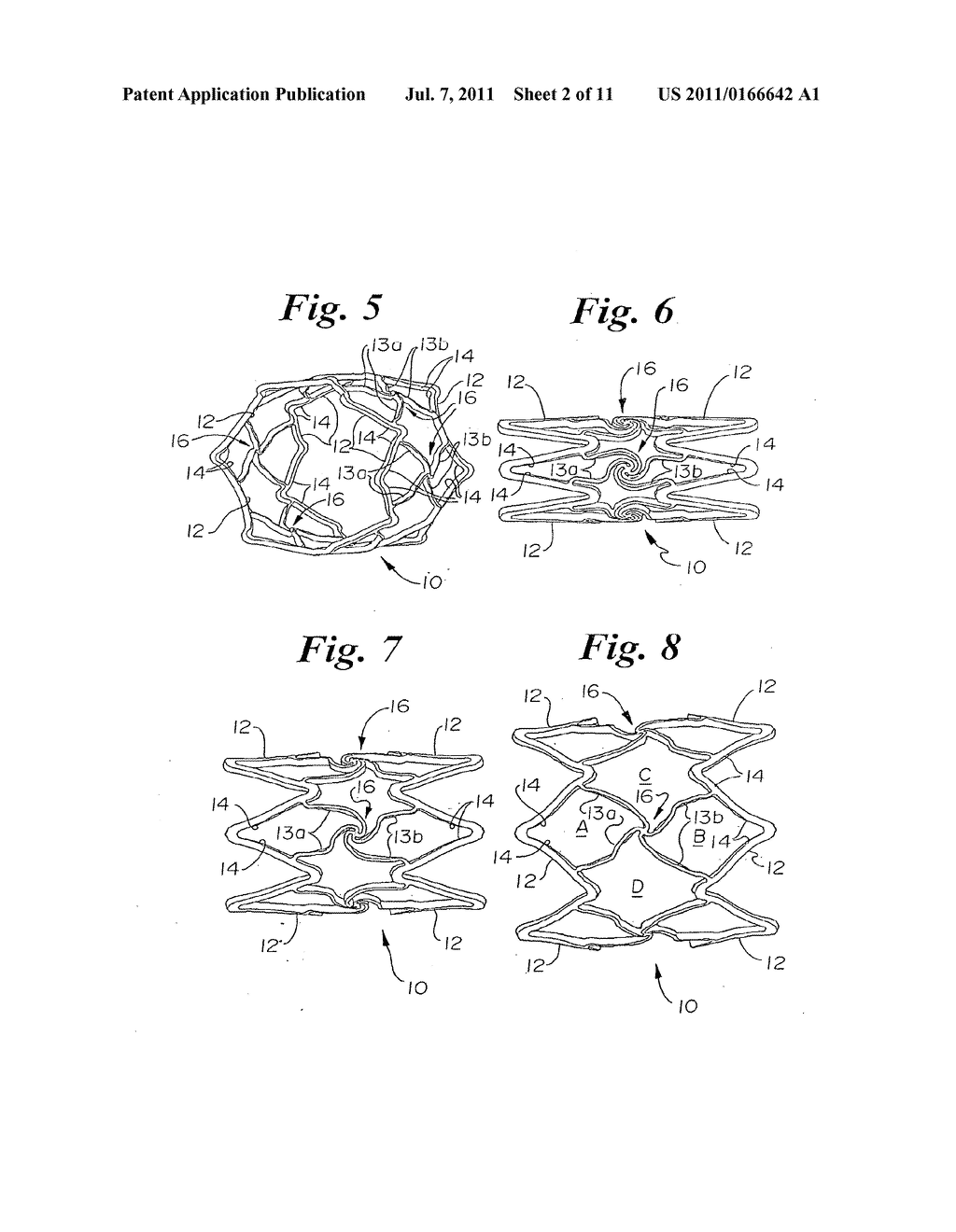 Stent Configurations - diagram, schematic, and image 03