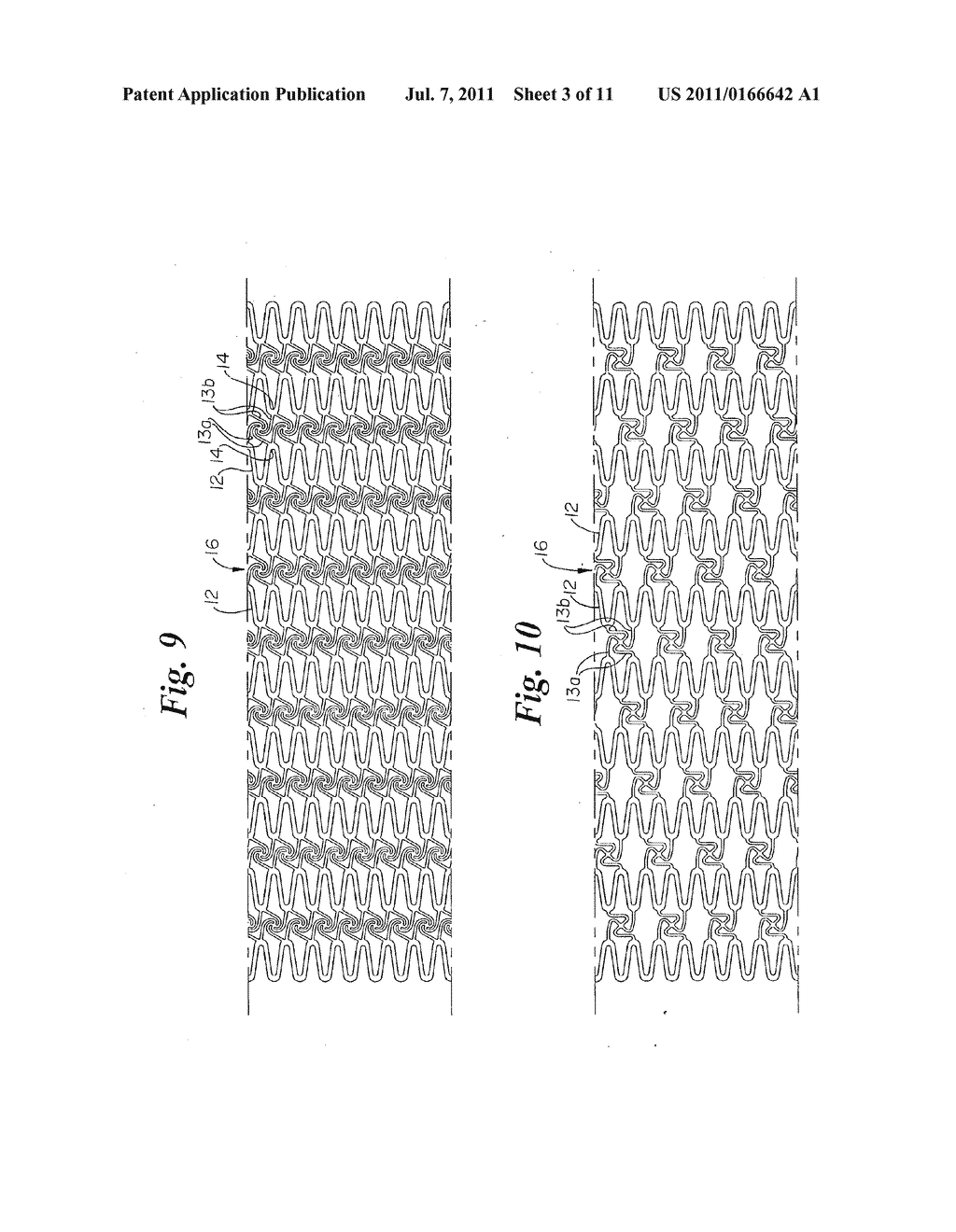 Stent Configurations - diagram, schematic, and image 04