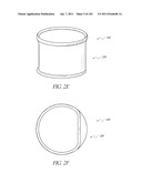 PROFILE REDUCTION OF VALVE IMPLANT diagram and image