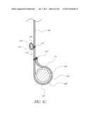 PROFILE REDUCTION OF VALVE IMPLANT diagram and image