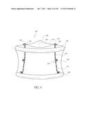 PROFILE REDUCTION OF VALVE IMPLANT diagram and image