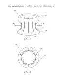 PROFILE REDUCTION OF VALVE IMPLANT diagram and image