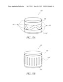 PROFILE REDUCTION OF VALVE IMPLANT diagram and image