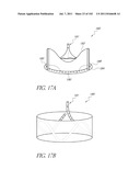 PROFILE REDUCTION OF VALVE IMPLANT diagram and image