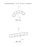 PROFILE REDUCTION OF VALVE IMPLANT diagram and image