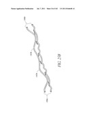 PROFILE REDUCTION OF VALVE IMPLANT diagram and image