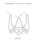 PROFILE REDUCTION OF VALVE IMPLANT diagram and image