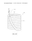 PROFILE REDUCTION OF VALVE IMPLANT diagram and image