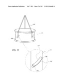 PROFILE REDUCTION OF VALVE IMPLANT diagram and image