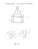 PROFILE REDUCTION OF VALVE IMPLANT diagram and image