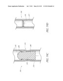 PROFILE REDUCTION OF VALVE IMPLANT diagram and image