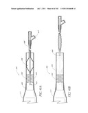 PROFILE REDUCTION OF VALVE IMPLANT diagram and image